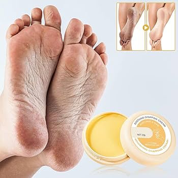 Hydrating Foot Repair Cream - Moisturizing Treatment