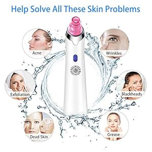 Pink Pore Perfection Vacuum - Blackhead Extractor