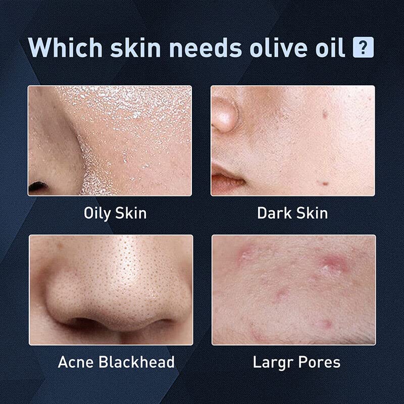 Men’s Exfoliating Acne & Oil-Control Mousse