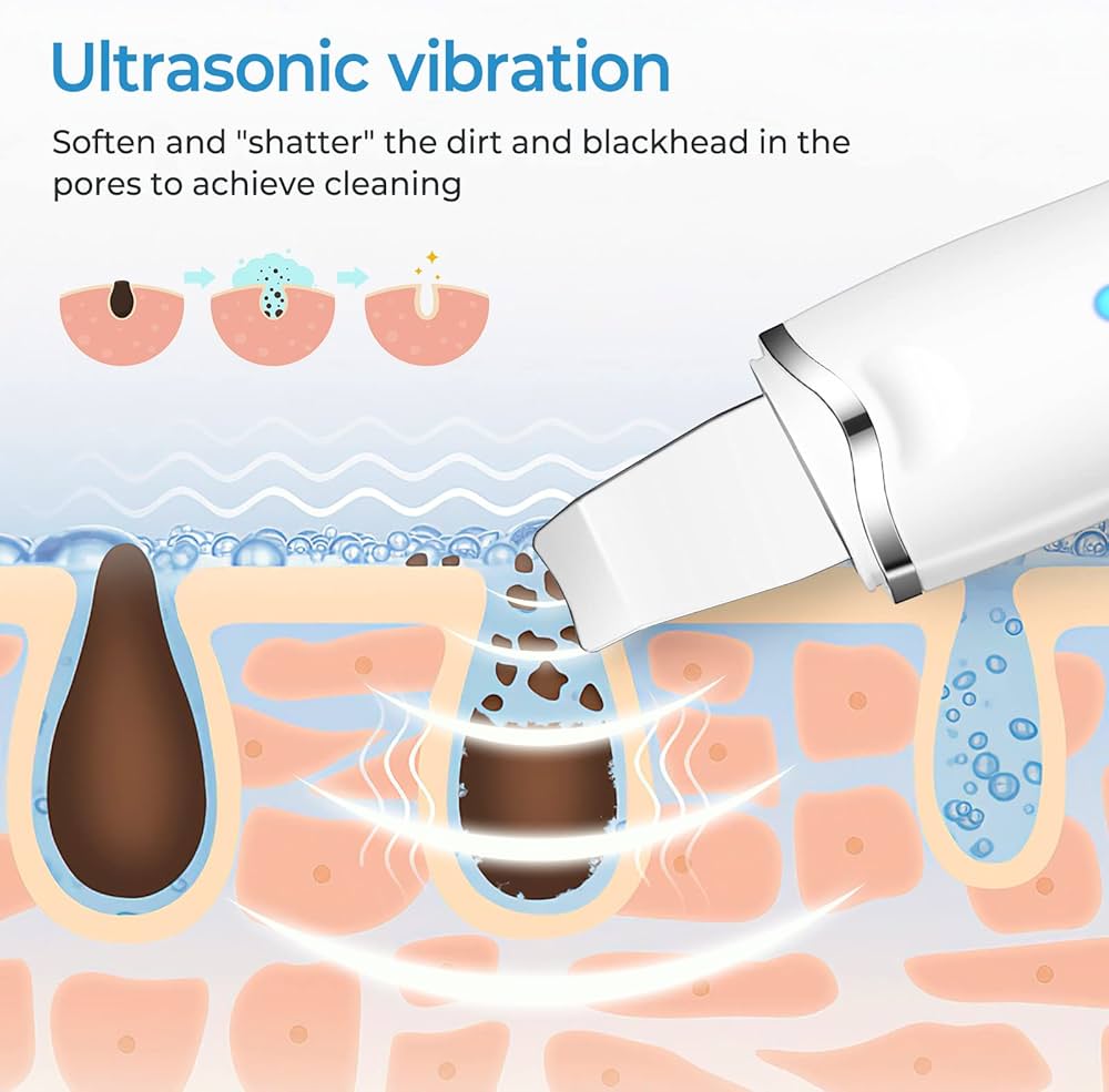 Ultrasonic Pore Cleaner - Deep Facial Cleansing