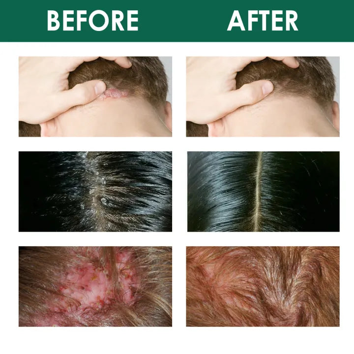 Scalp Care Essence – Nourish & Smooth Hair Naturally