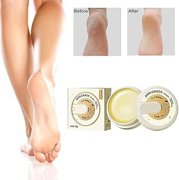 Hydrating Foot Repair Cream - Moisturizing Treatment
