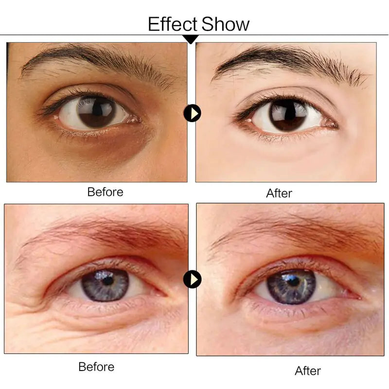 Crystal Collagen Eye Patches - Hydrating Treatment