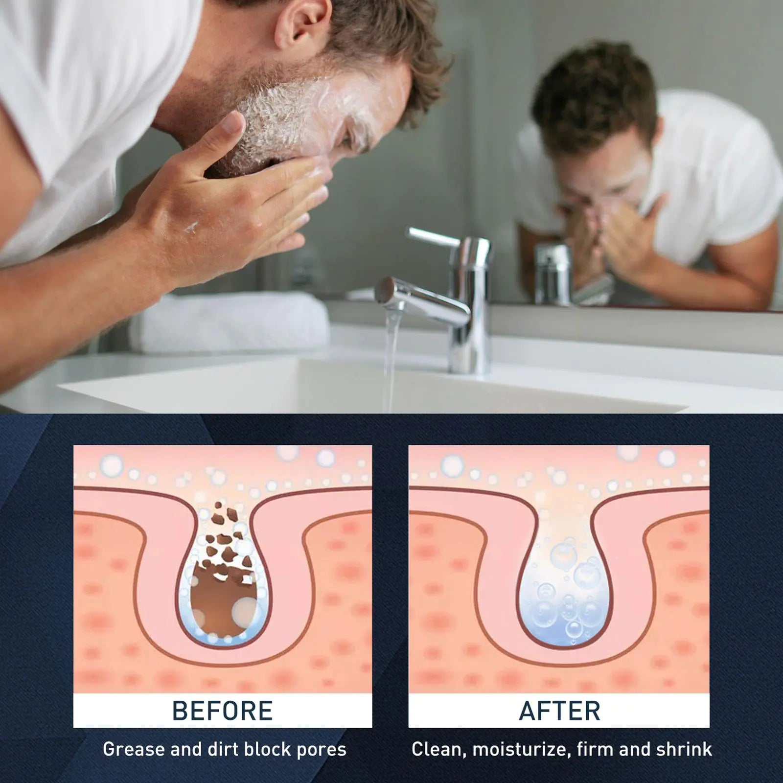Men’s Exfoliating Acne & Oil-Control Mousse