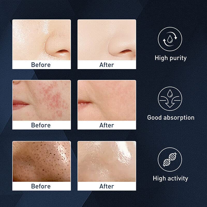 Men’s Exfoliating Acne & Oil-Control Mousse