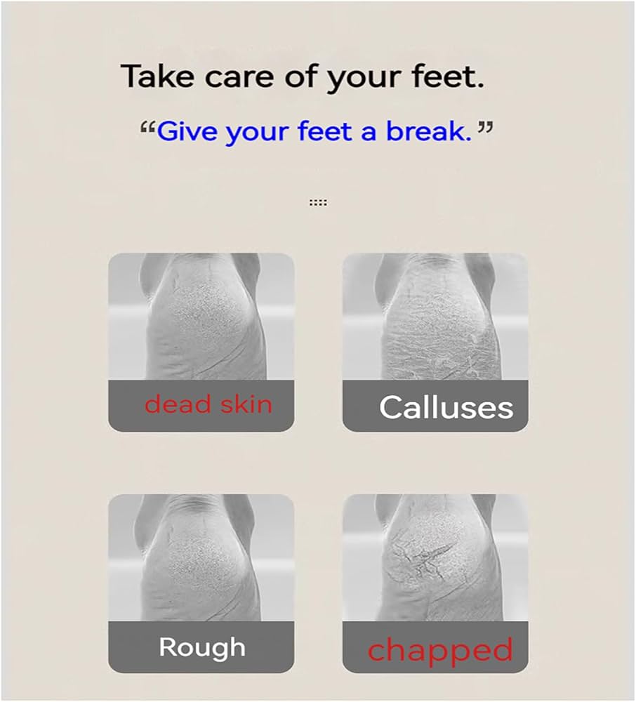 Rechargeable Foot Care Grinder - Callus Remover
