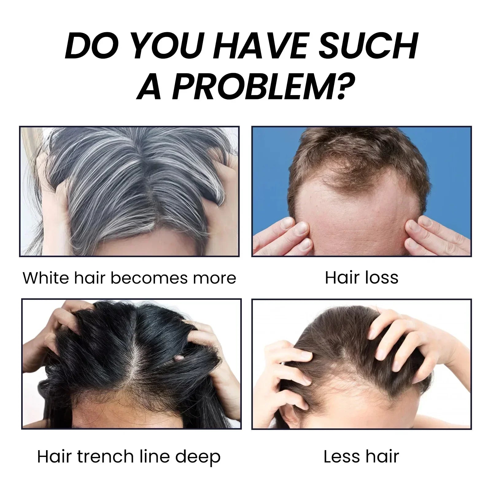 Hair Dense Essence – Anti-Hair Loss & Nourishing Oil