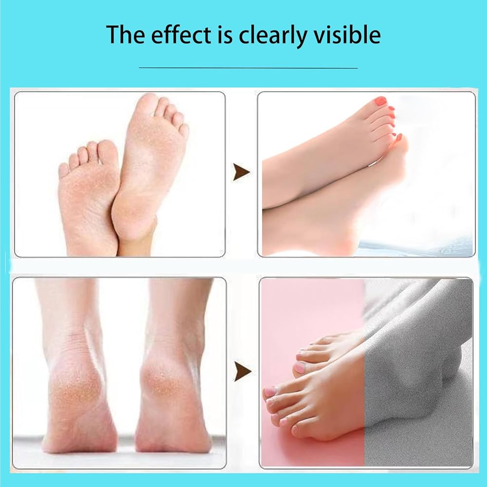 Rechargeable Foot Care Grinder - Callus Remover