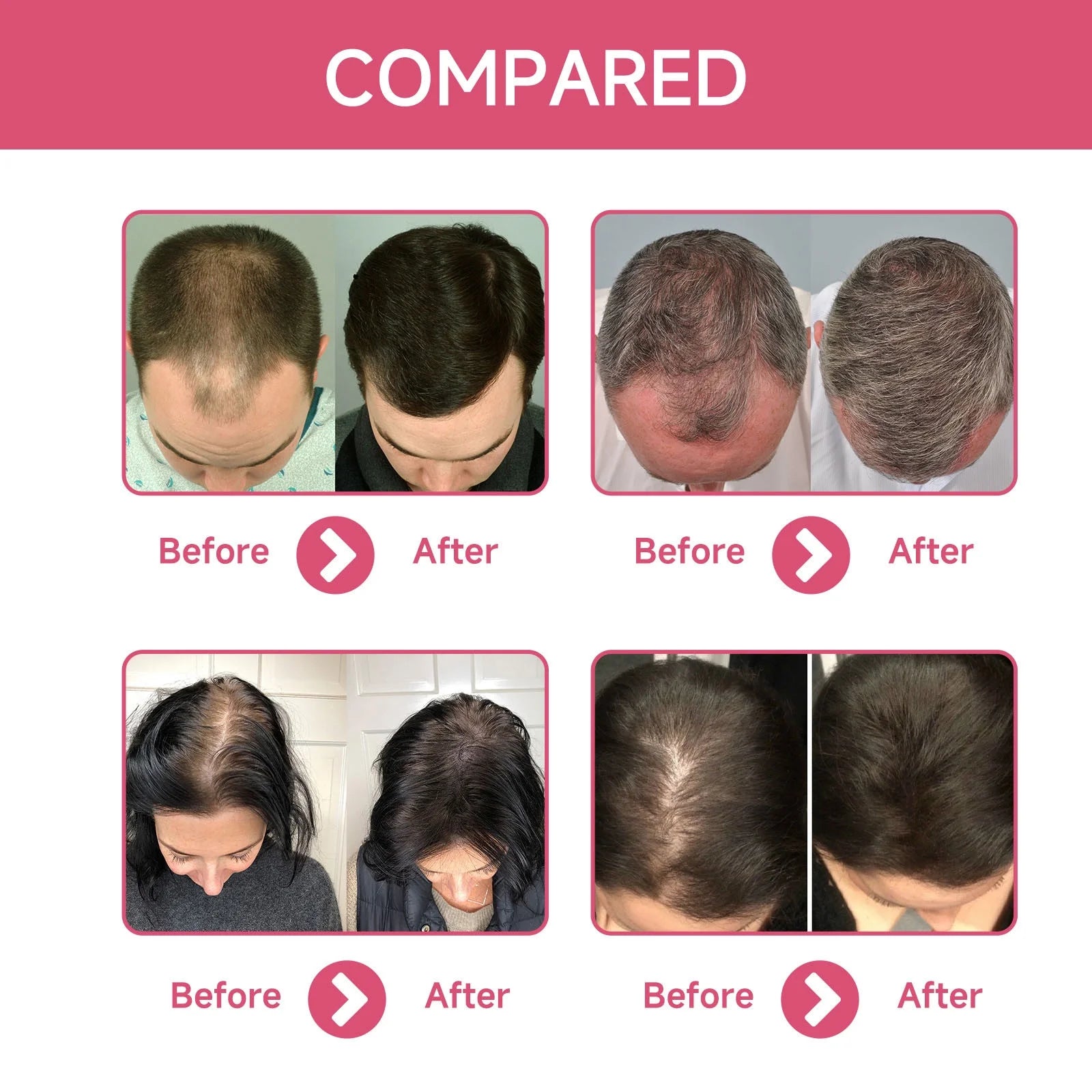 Hair Dense Essence – Anti-Hair Loss & Nourishing Oil