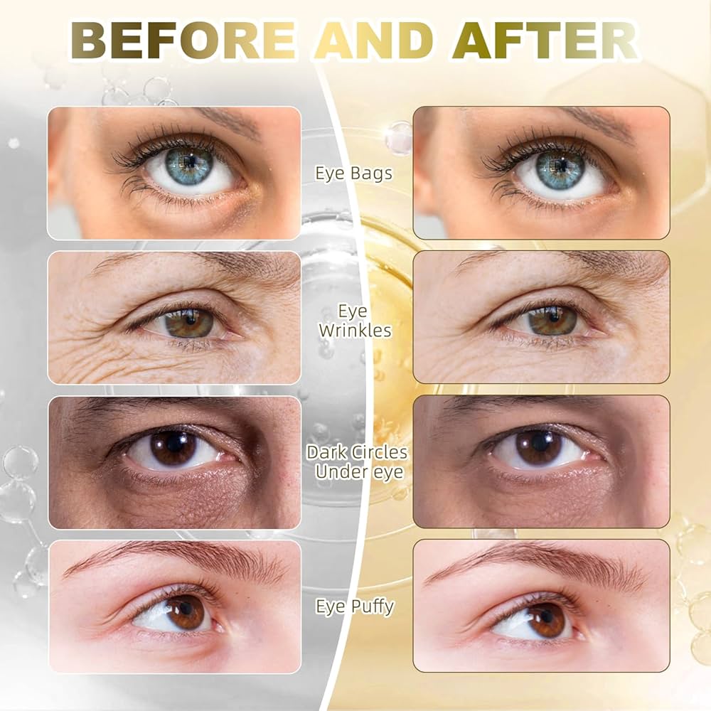 Collagen Eye Masks 30 Pairs - Anti-Aging Treatment