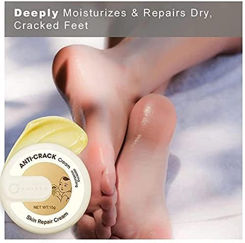 Hydrating Foot Repair Cream - Moisturizing Treatment