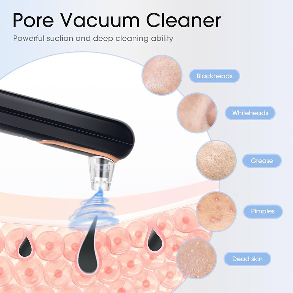 Professional Pore Vacuum Black - Blackhead Removal