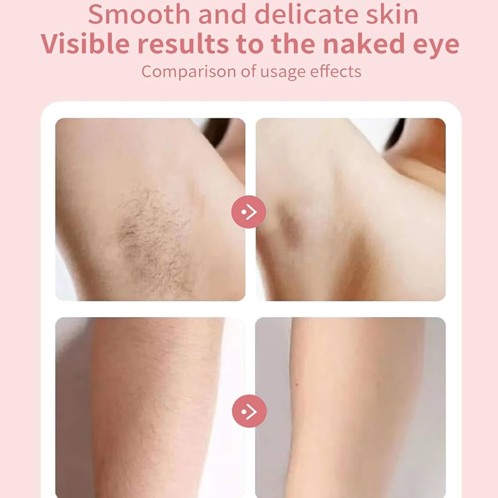 2-in-1 Hair Removal Epilator USB - Electric Trimmer