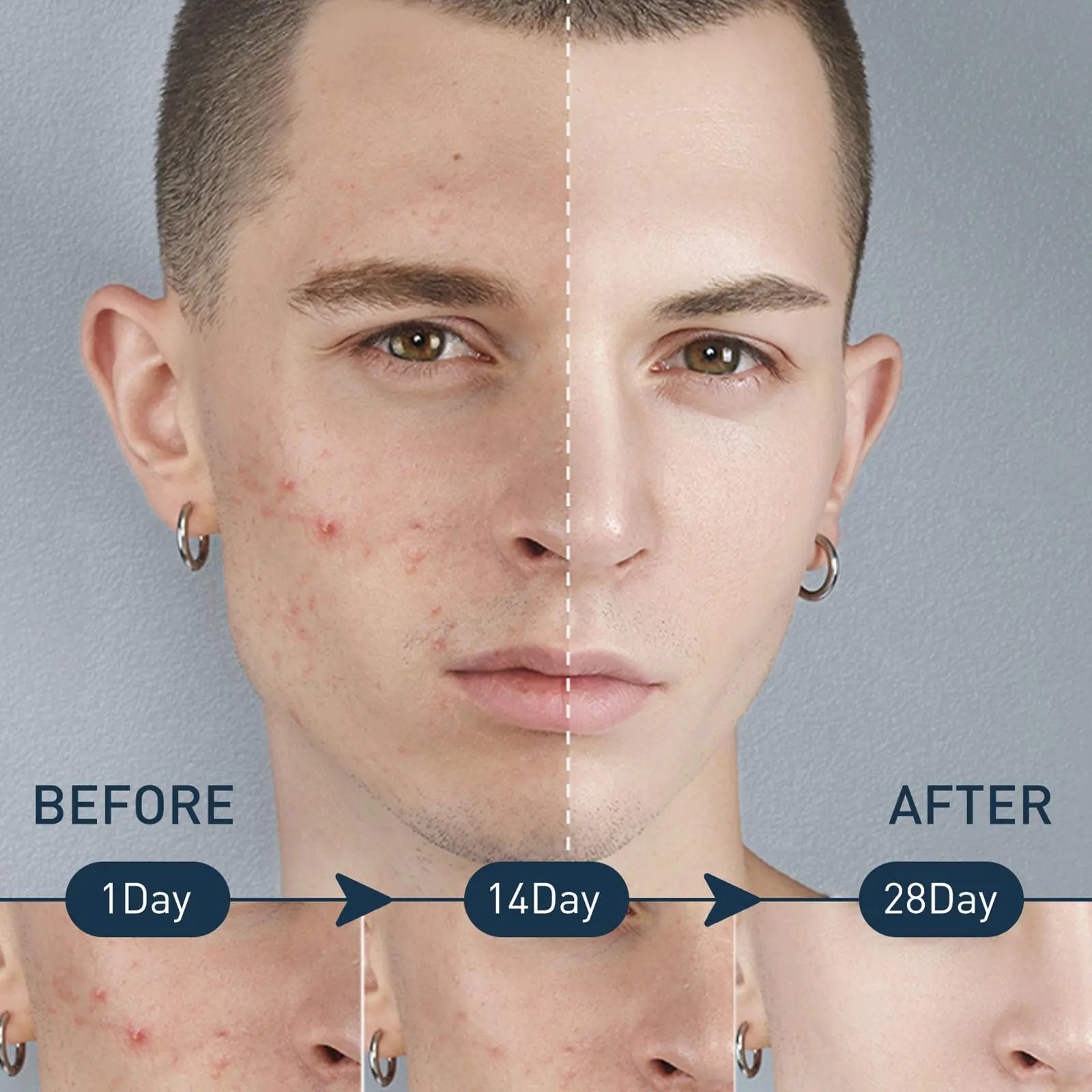 Men’s Exfoliating Acne & Oil-Control Mousse