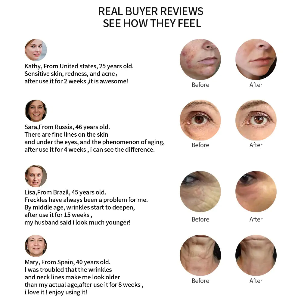 LED Light Therapy Facial Massager - Anti-Aging