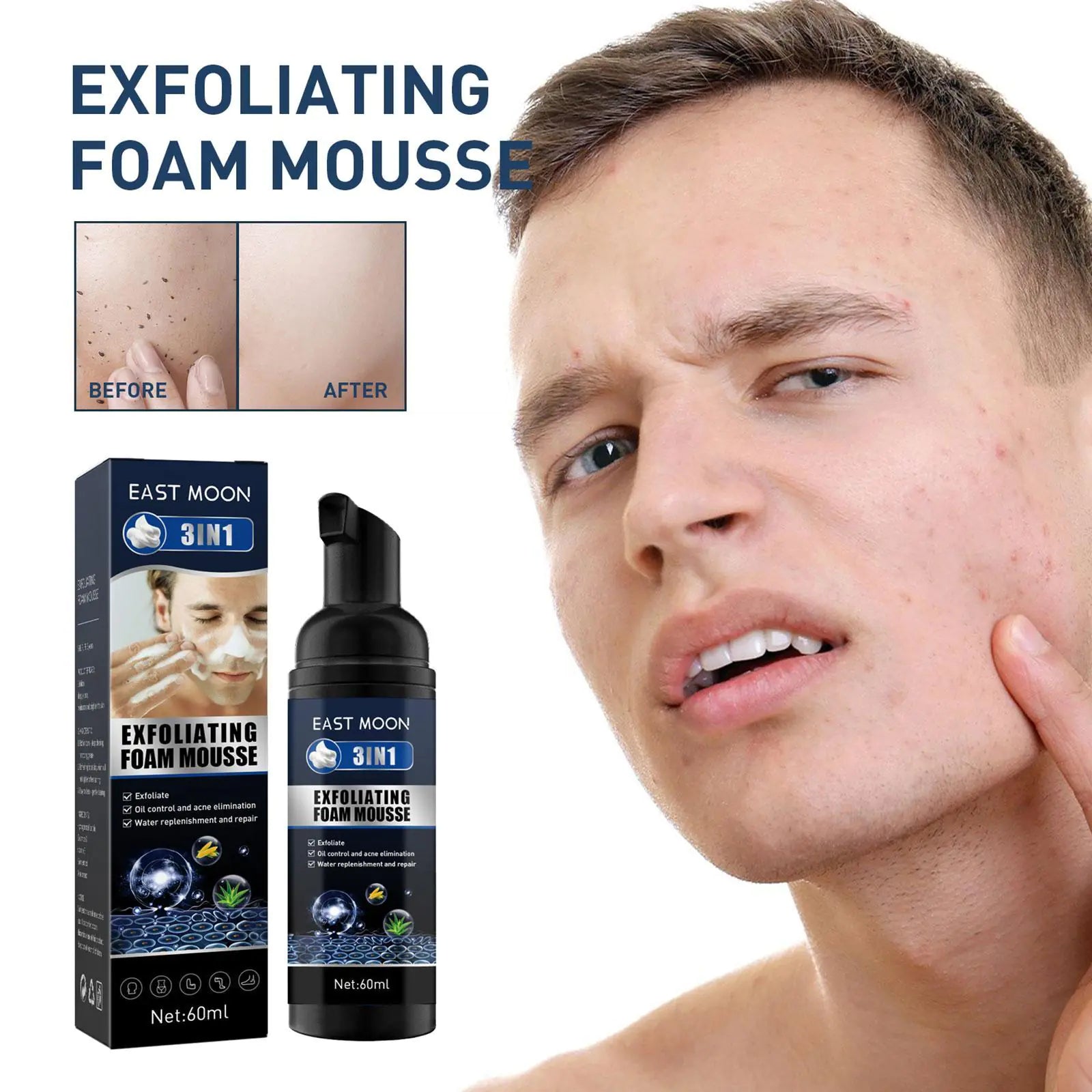 Men’s Exfoliating Acne & Oil-Control Mousse