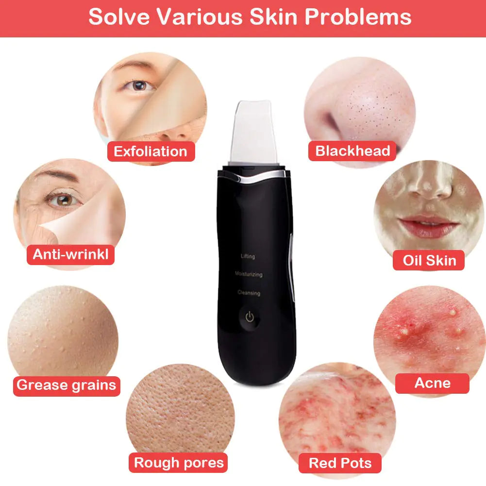 Ultrasonic Pore Cleaner - Deep Facial Cleansing