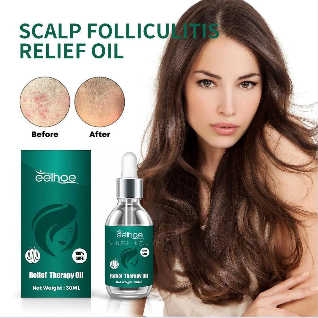 Scalp Care Essence – Nourish &amp; Smooth Hair Naturally