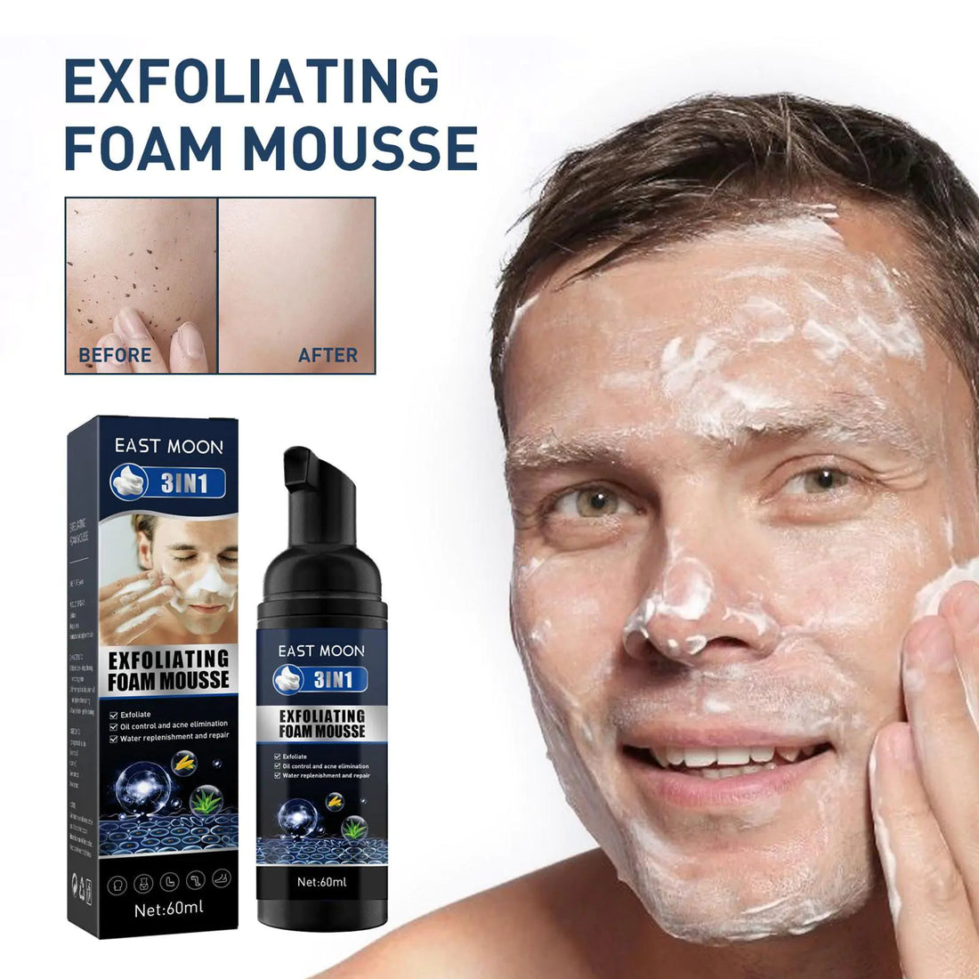 Men’s Exfoliating Acne &amp; Oil-Control Mousse