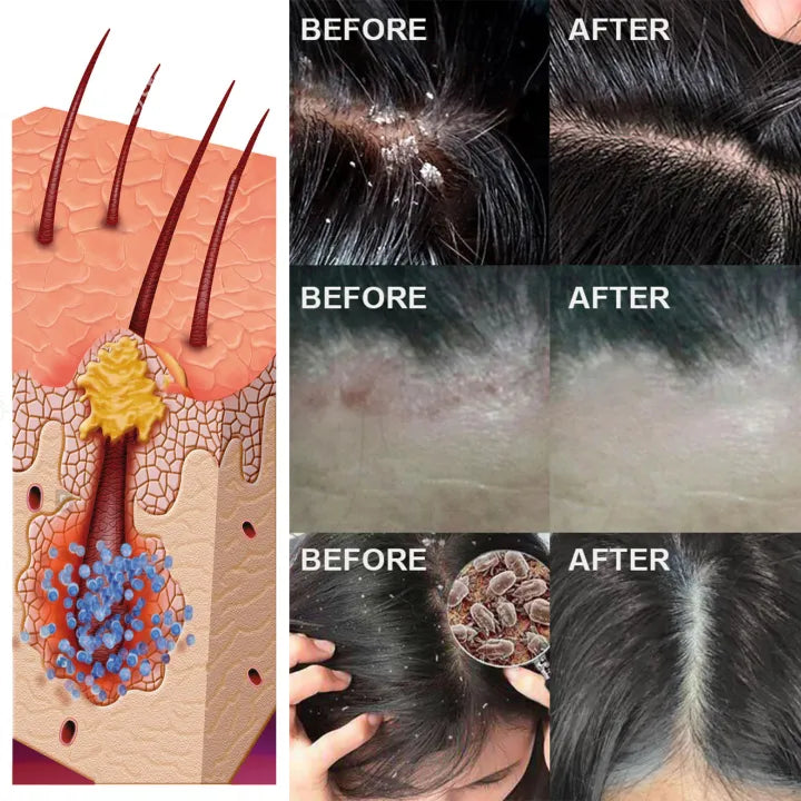 Scalp Care Essence – Nourish &amp; Smooth Hair Naturally