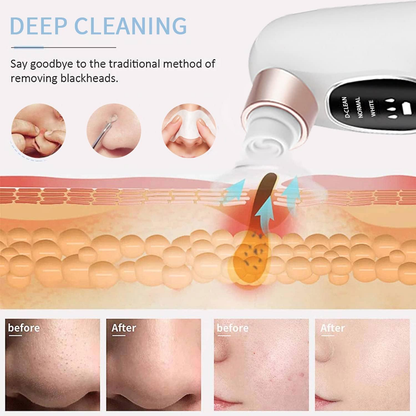 Pore Vacuum Pro