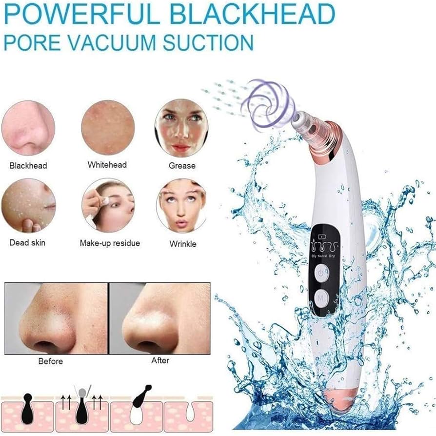 Advanced Pore Vacuum &amp; Blackhead Extractor 2025