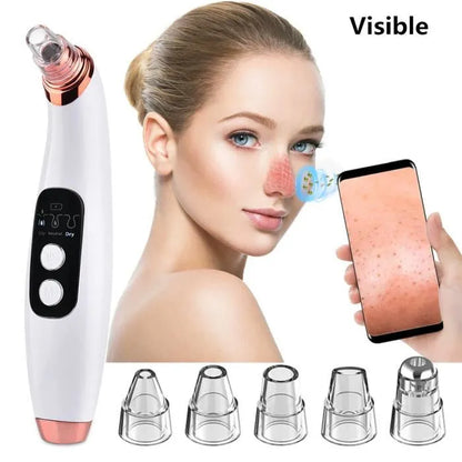 Advanced Pore Vacuum &amp; Blackhead Extractor 2025