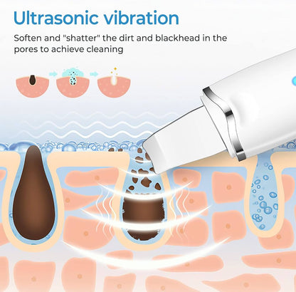 Ultrasonic Pore Cleaner - Deep Facial Cleansing
