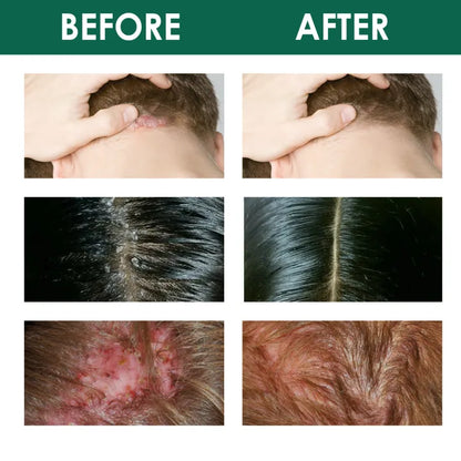 Scalp Care Essence – Nourish &amp; Smooth Hair Naturally