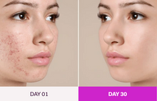 Load image into Gallery viewer, Facial Massager For Woman