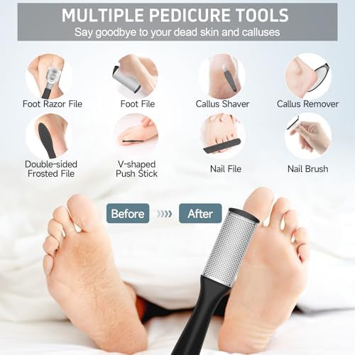 Rechargeable Foot Callus Eliminator - Smooth Feet