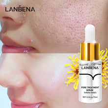 Load image into Gallery viewer, Pore Tightening Serum Minimize Pores &amp; Control Oil