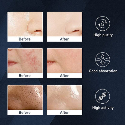 Men’s Exfoliating Acne &amp; Oil-Control Mousse