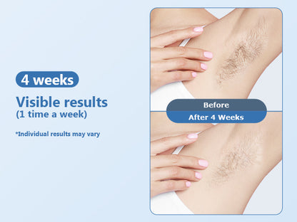 IPL Laser Hair Removal 3-in-1 - Home Device Cooling