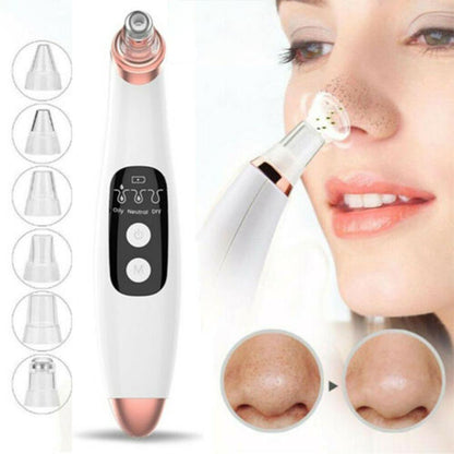 Advanced Pore Vacuum &amp; Blackhead Extractor 2025