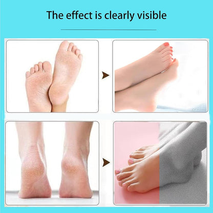 Rechargeable Foot Care Grinder - Callus Remover