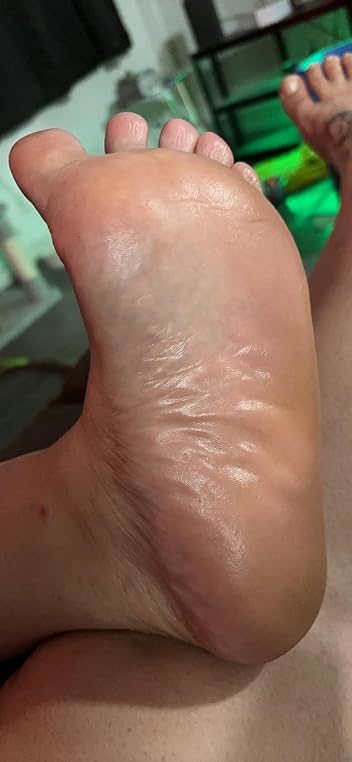 Electric Foot Callus Remover - Professional Pedicure