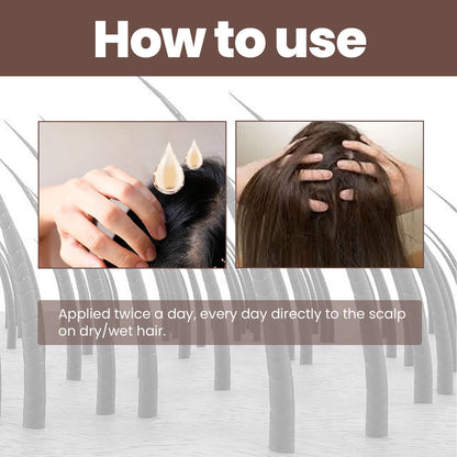 Hair Dense Essence – Anti-Hair Loss &amp; Nourishing Oil