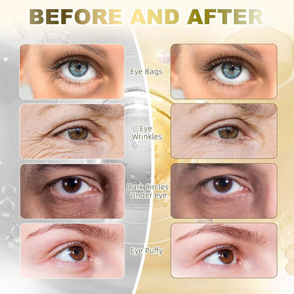 Collagen Eye Masks 30 Pairs - Anti-Aging Treatment