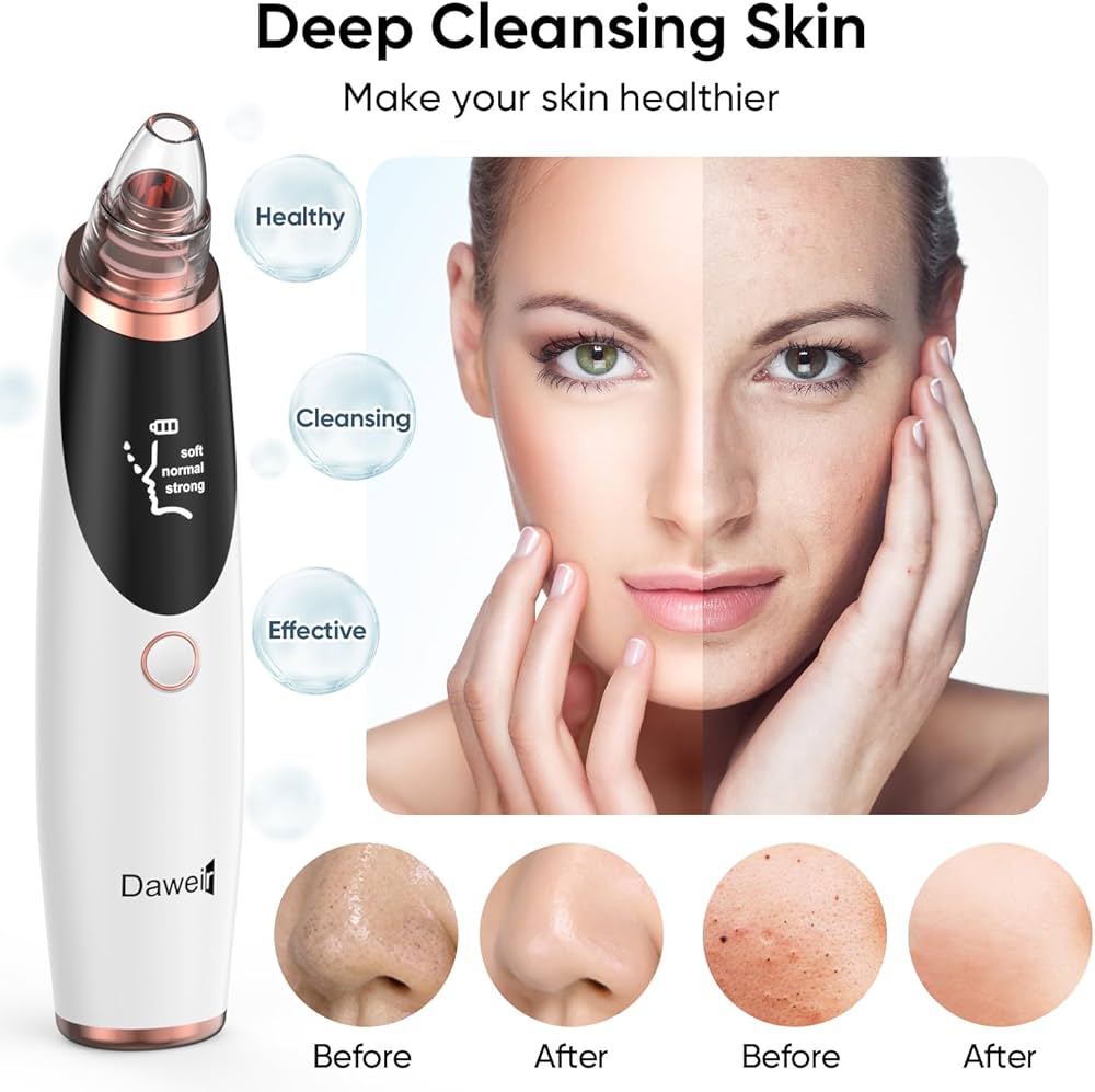 Daweir Pore Perfect Vacuum - Deep Cleansing Device
