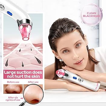 Pink Pore Perfection Vacuum - Blackhead Extractor