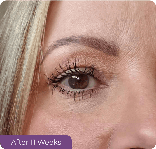 Eyelash Growth Serum
