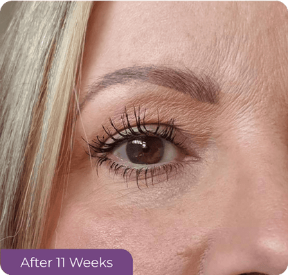 Eyelash Growth Serum