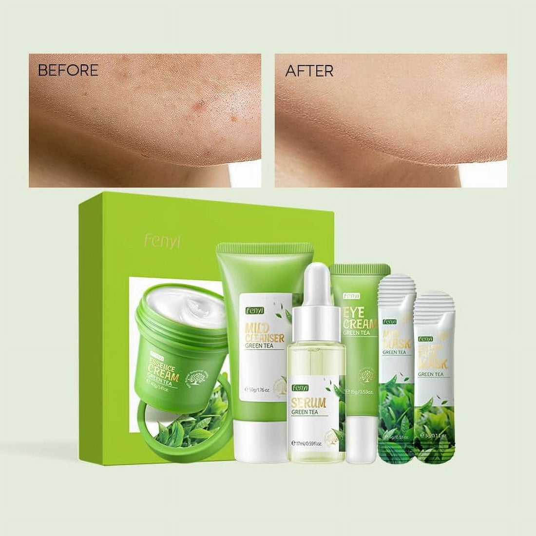 Green Tea Skincare Gift Set – 6-in-1 Complete Routine
