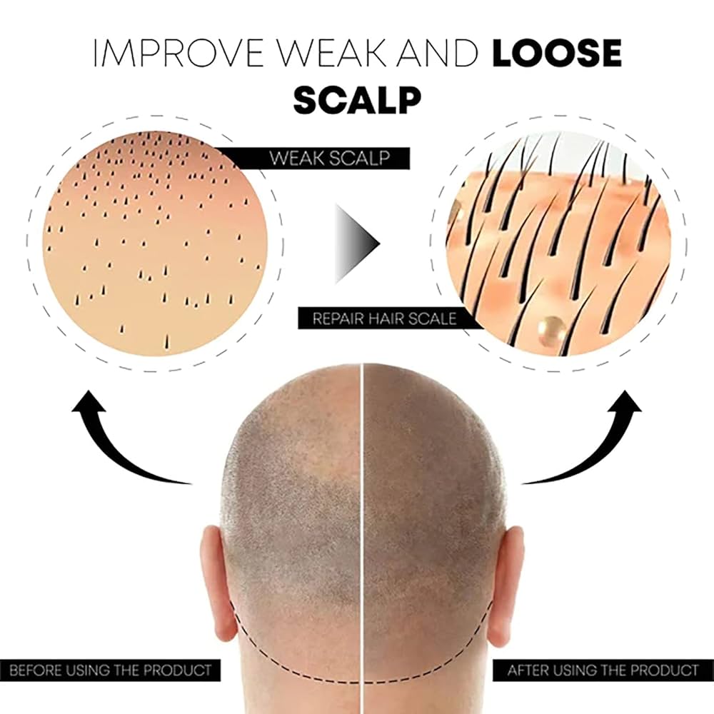 Scalp Care Essence – Nourish &amp; Smooth Hair Naturally