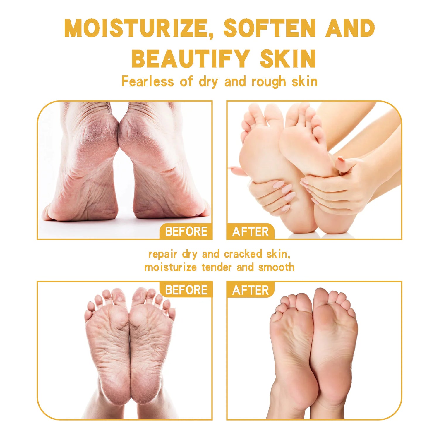Hydrating Foot Repair Cream - Moisturizing Treatment