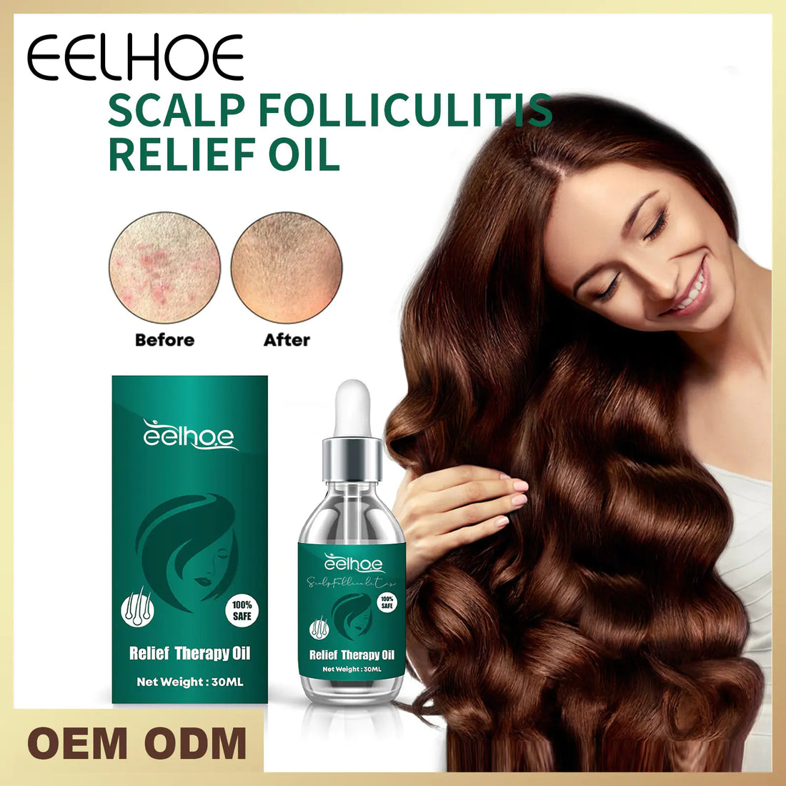 Scalp Care Essence – Nourish &amp; Smooth Hair Naturally