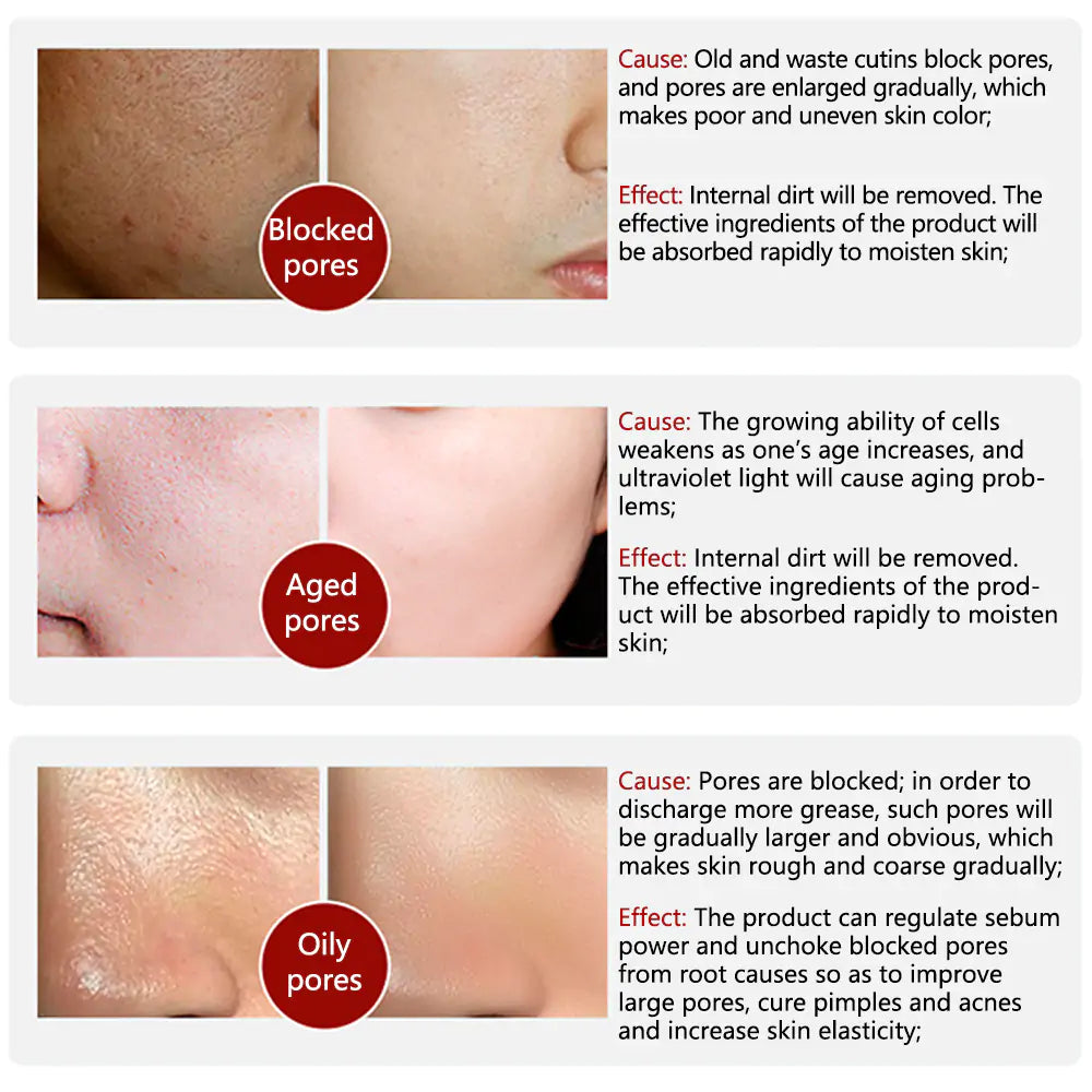 Pore Tightening Serum Minimize Pores &amp; Oil Control