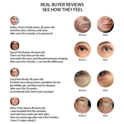 LED Light Therapy Facial Massager - Anti-Aging