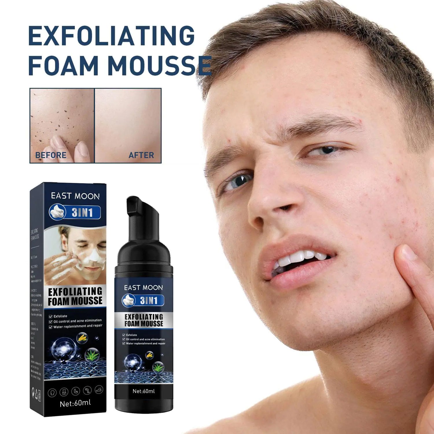 Men’s Exfoliating Acne &amp; Oil-Control Mousse